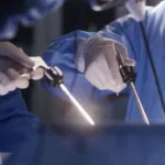 What Is Gastric Sleeve Surgery?